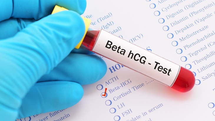 Plano de saúde cobre exame beta HCG
