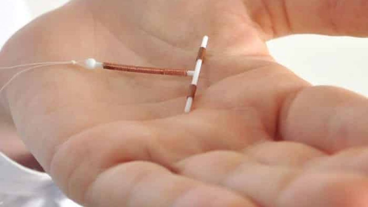 Plano de saúde cobre DIU?