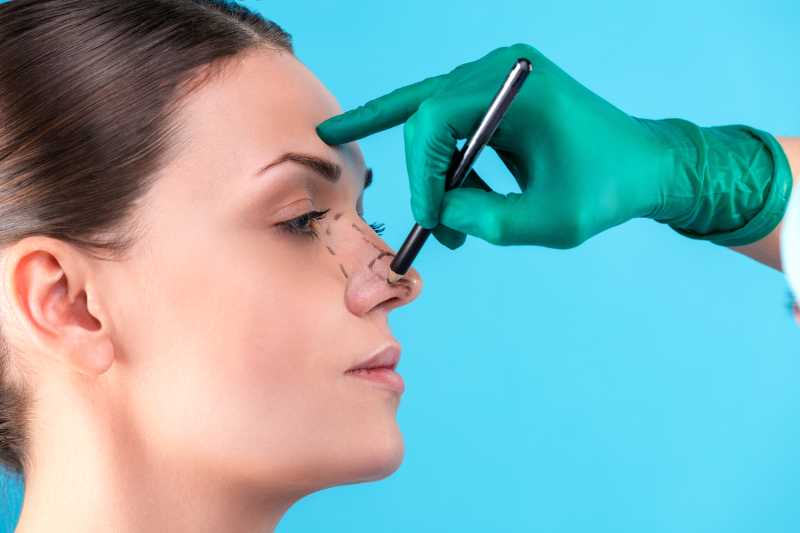Plano de saúde cobre rinoplastia?