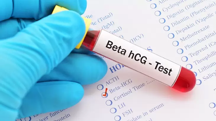 Plano de saúde cobre exame beta HCG