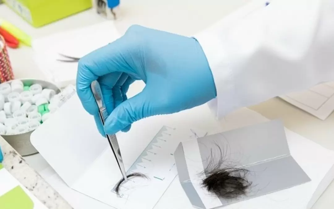 Plano de saúde cobre exame toxicológico?