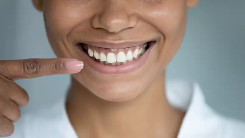 Plano de saúde cobre gengivoplastia?
